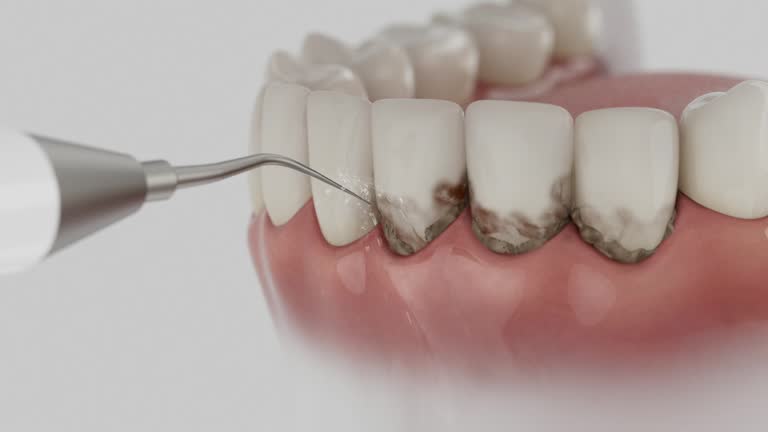 Reliable Dental Implants contractor in Morris, AL by Smile Center Dentistry